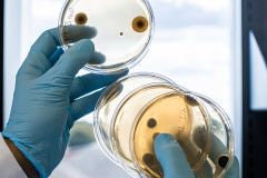 Petri dishes containing TurtleTree's growing microbial colonies.