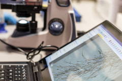 A microscopic look at how mycoproteins form and interact with one another at The Better Meat Company. Rhiza mycoproteins are fermented and are sold to companies as replacement to animal proteins.